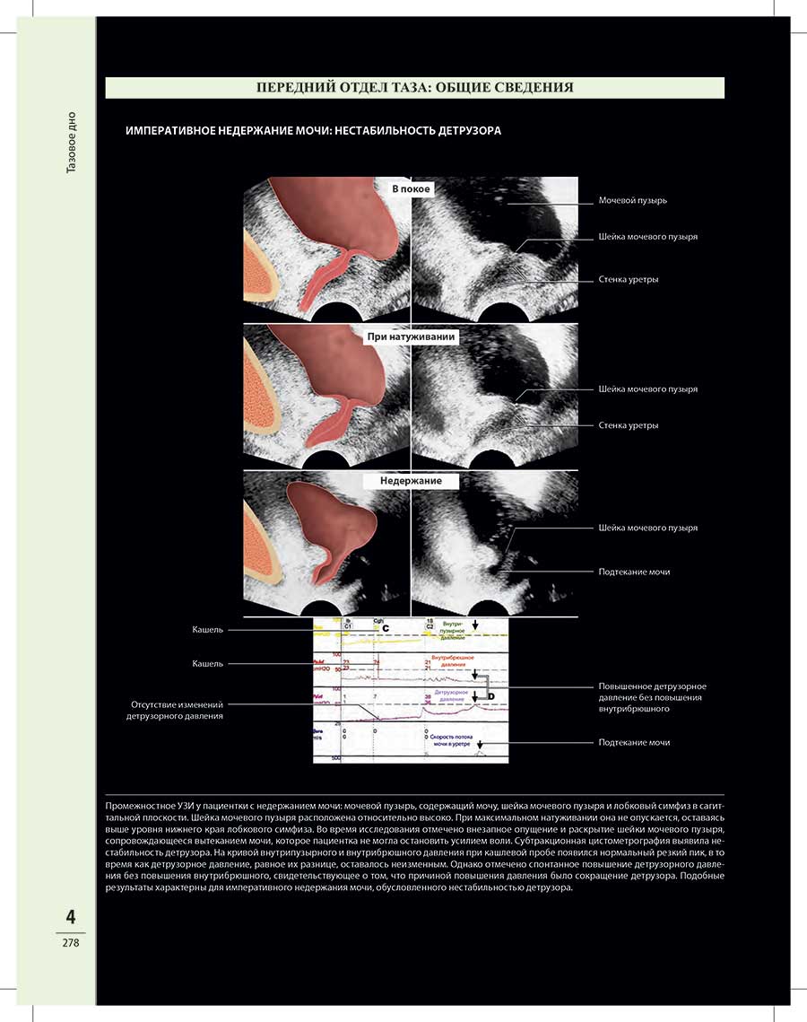 Пример страницы из книги  "Диагностическая визуализация в гинекологии: в трех томах" Том 3