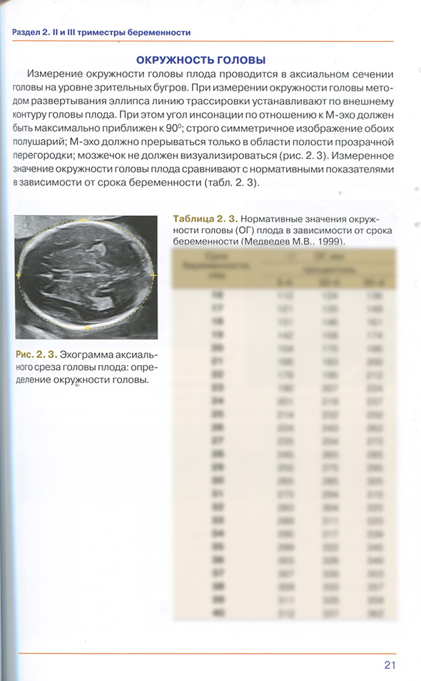 Эхограмма аксиального среза головы плода: определение окружности головы