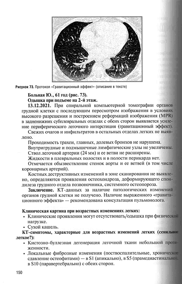 Протокол «Гравитационный эффект* (описание в тексте)