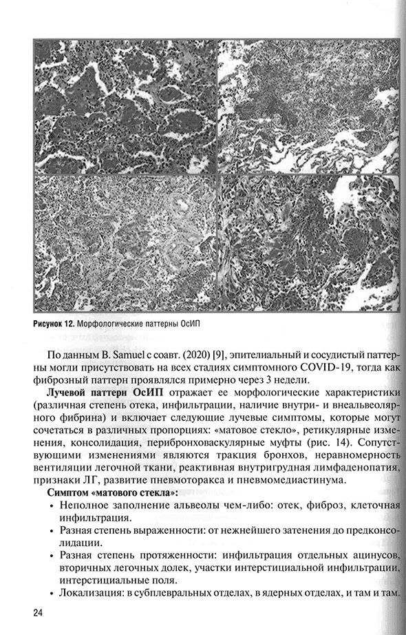 Морфологические паттерны ОсИП