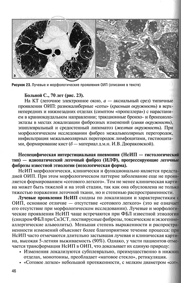 Лучевые и морфологические проявления ОИП (описание в тексте)