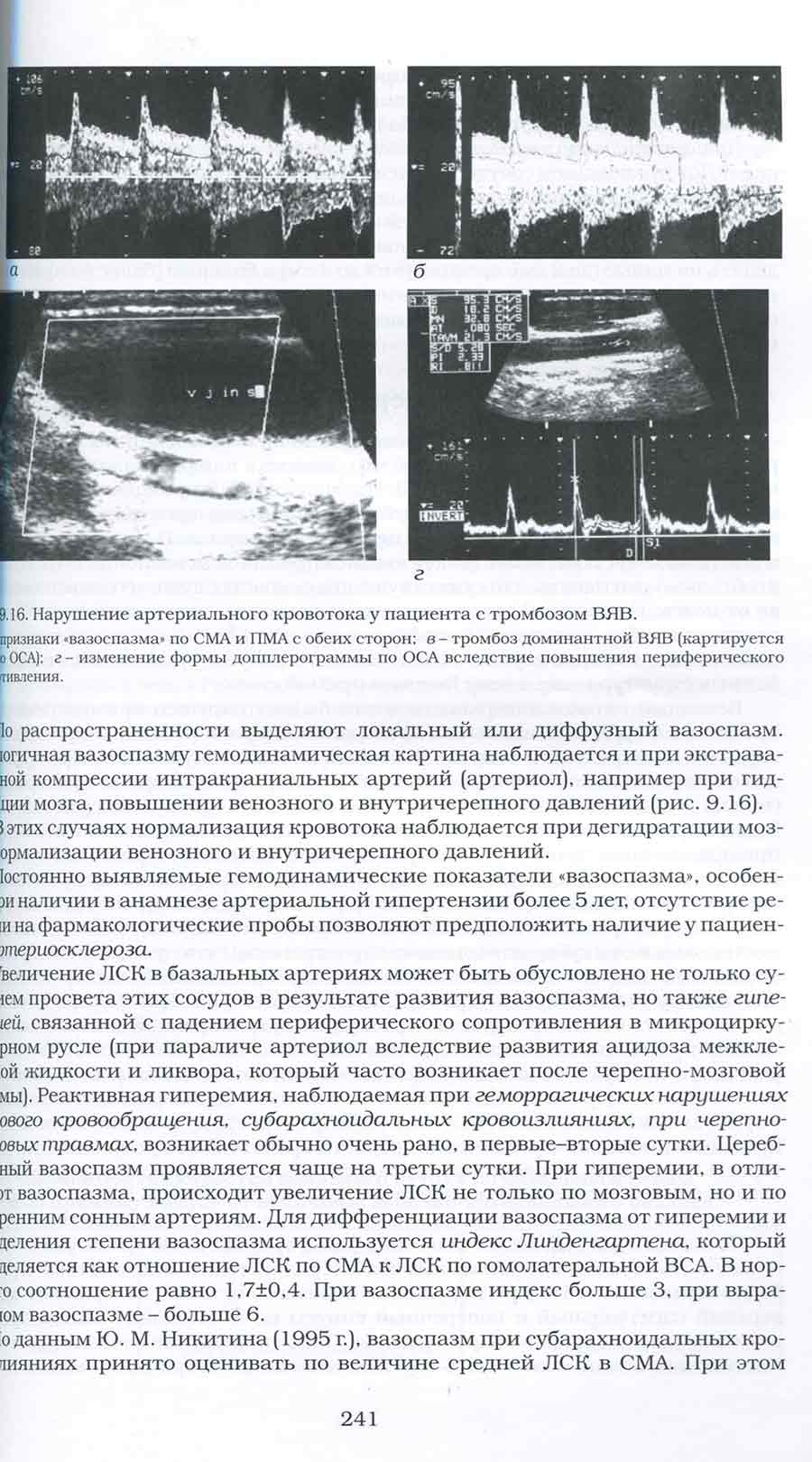 Примеры страниц из книги "Комплексная ультразвуковая диагностика патологии периферических сосудов"