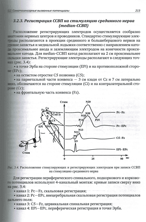 Расположение стимулирующих и регистрирующих электродов при записи ССВП