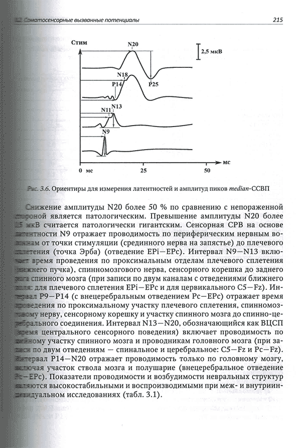 Ориентиры для измерения латентностей и амплитуд пиков