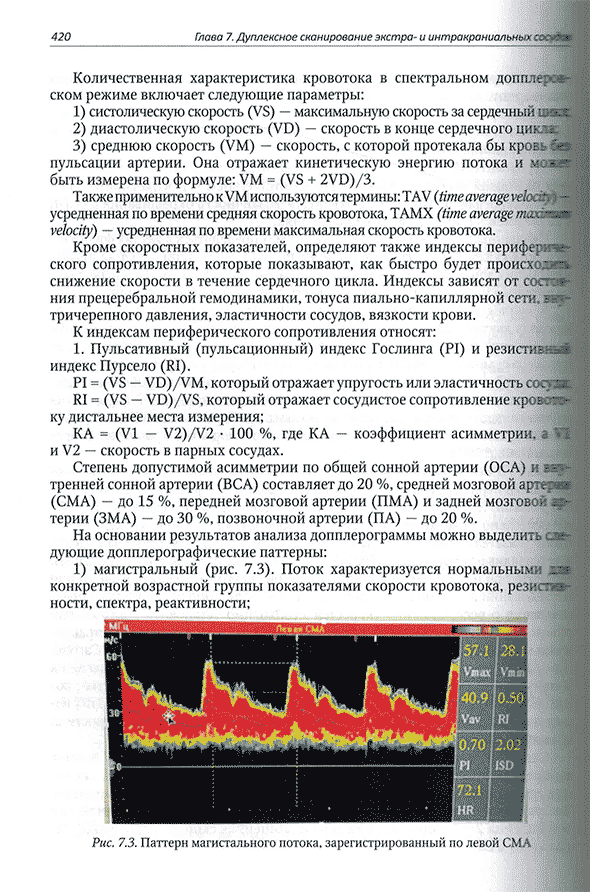 Паттерн магистрального потока, зарегистрированный полевой СМА