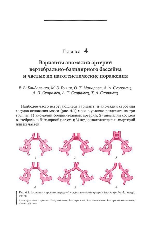 Варианты строения передней соединительной артерии