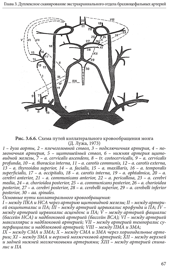 Схема путей коллатерального кровообращения мозга