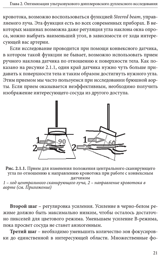 Рис. 2.1.1. Прием для изменения положения центрального сканирующего угла но отношению к направлению кровотока при работе с конвексным датчиком