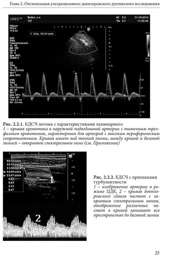 КДСЧ с признаками турбулентности