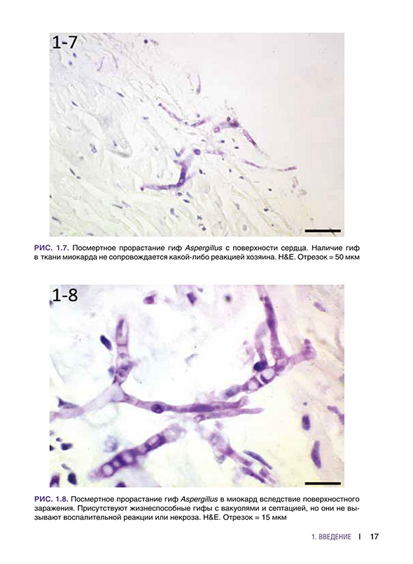Посмертное прорастание гиф Aspergillus Посмертное прорастание гиф Aspergillus