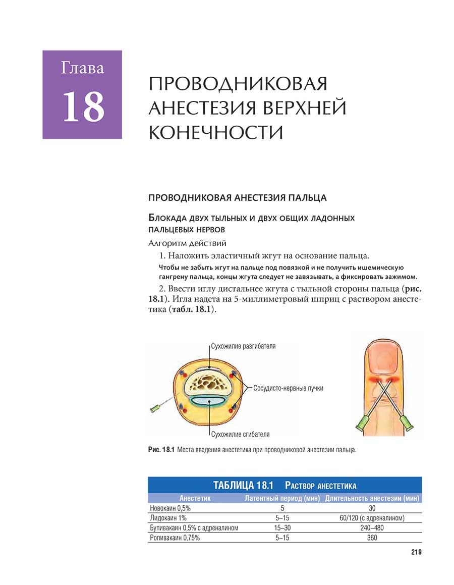 Рис. 18.1 Места введения анестетика при проводниковой анестезии пальца.