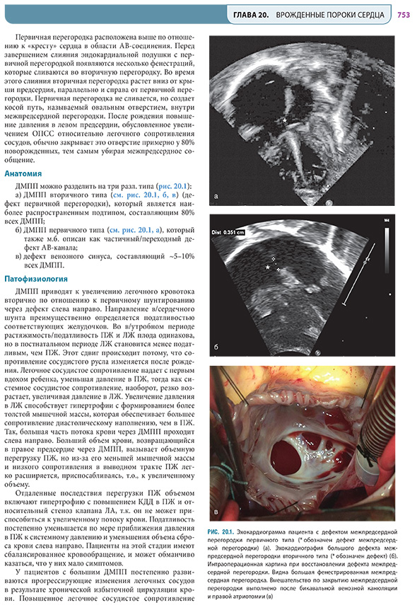 Эхокардиограмма пациента с дефектом межпредсердной перегородки первичного типа Эхокардиограмма пациента с дефектом межпредсердной перегородки первичного типа