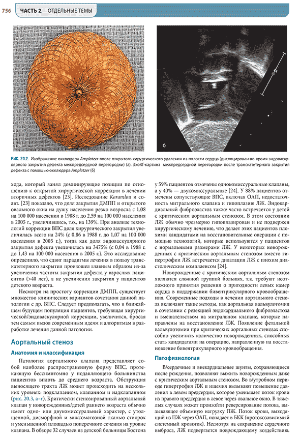 Изображение окклюдера Amplatzеr после открытого хирургического удаления из полости сердца Изображение окклюдера Amplatzеr после открытого хирургического удаления из полости сердца