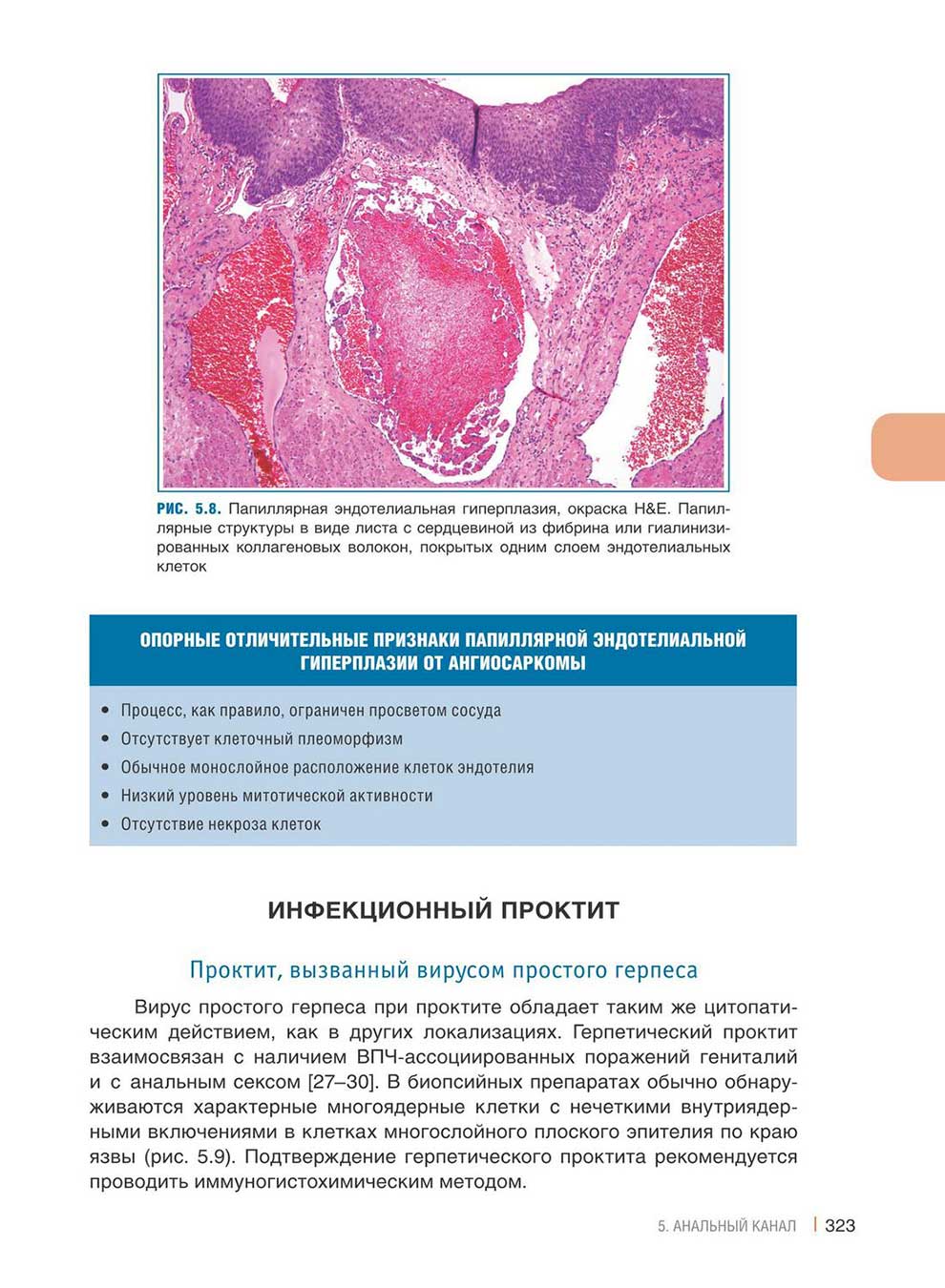 Папиллярная эндотелиальная гиперплазия