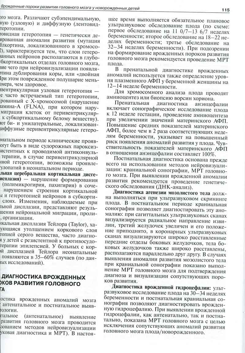 Врожденные пороки развития головного мозга Врожденные пороки развития головного мозга