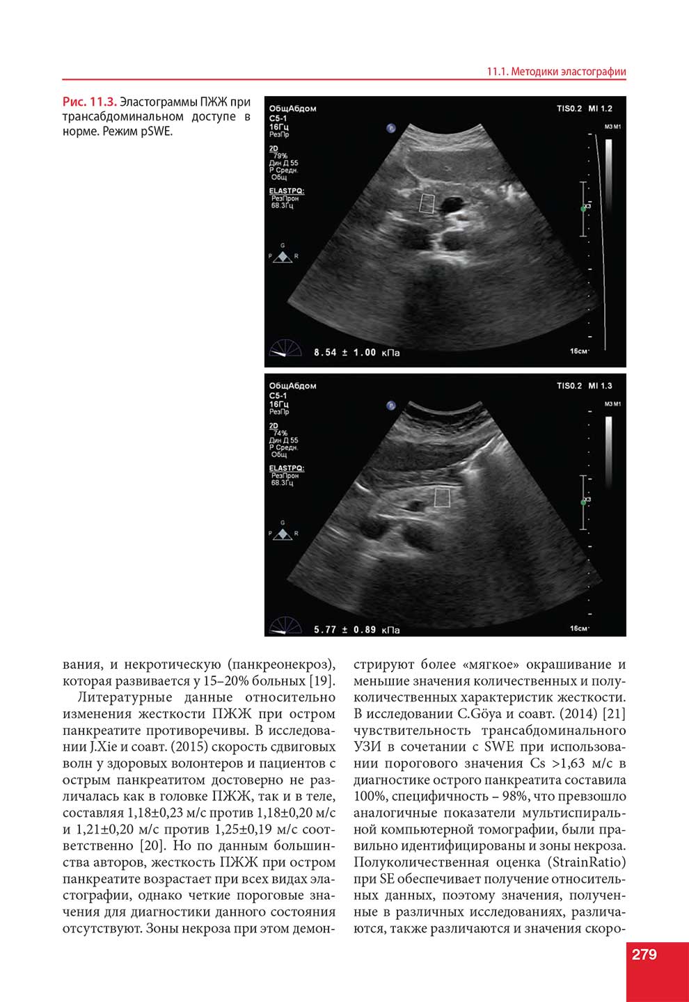 Рис. 11.3. Эластограммы ПЖЖ при трансабдоминальном доступе в норме. Режим pSWE.