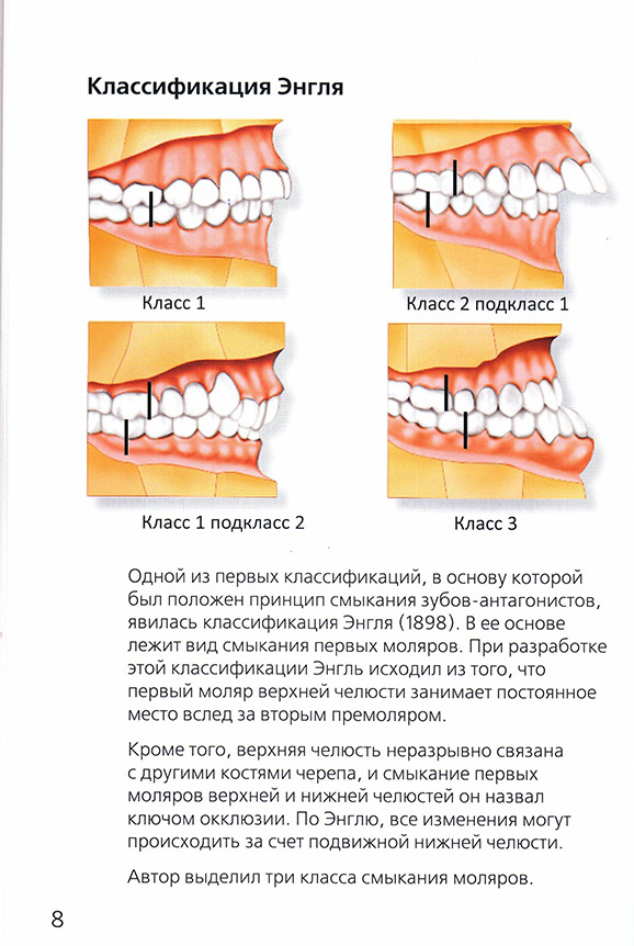 Классификация Энгля
