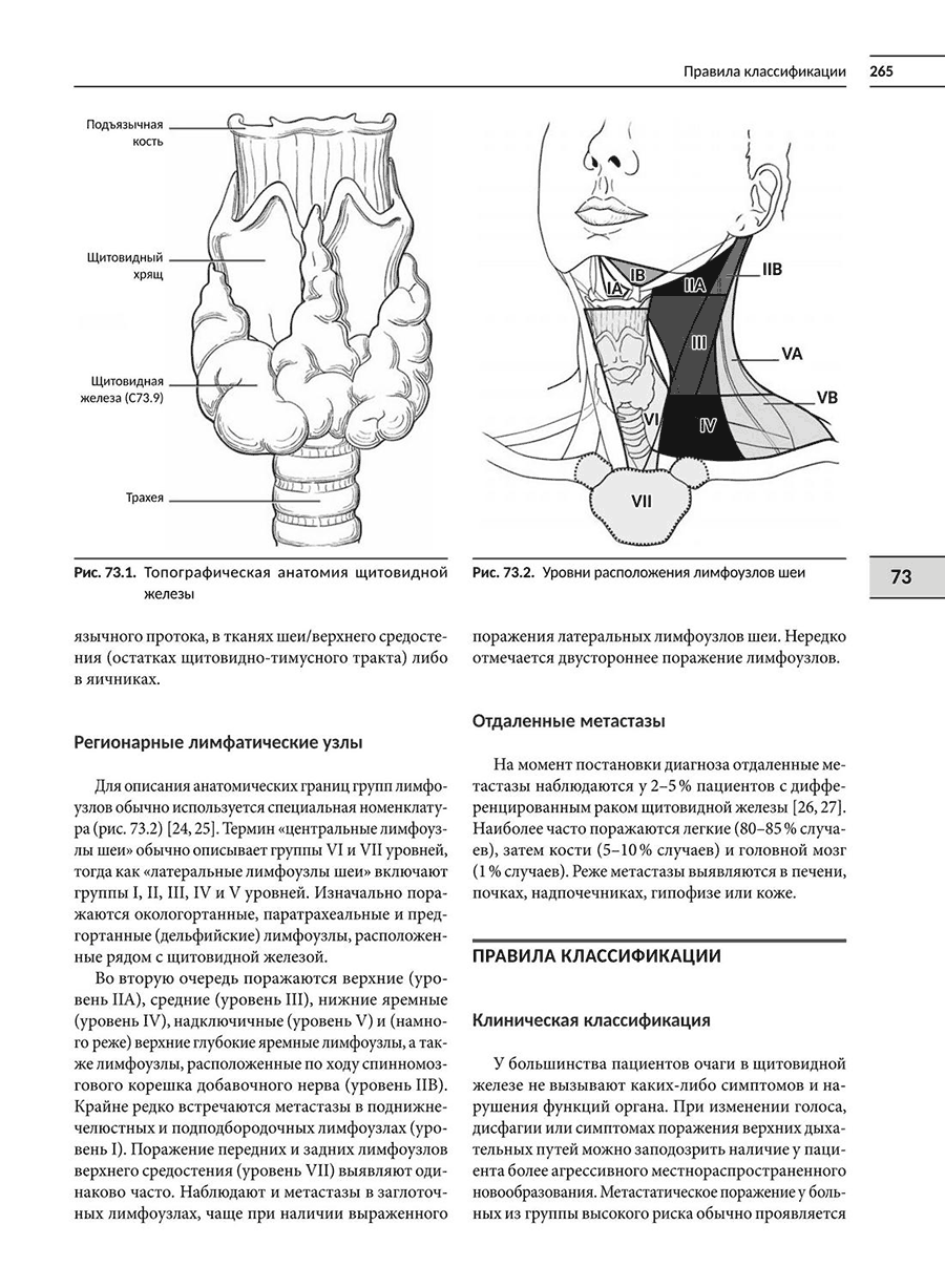 Рис. 73.1. Топографическая анатомия щитовидной железы