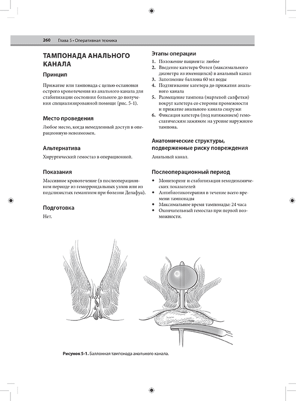 Баллонная тампонада анального канала.
