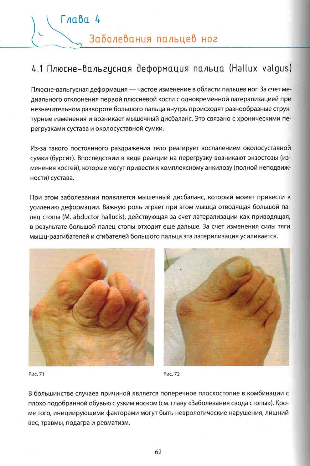 Заболебания пальцев ног