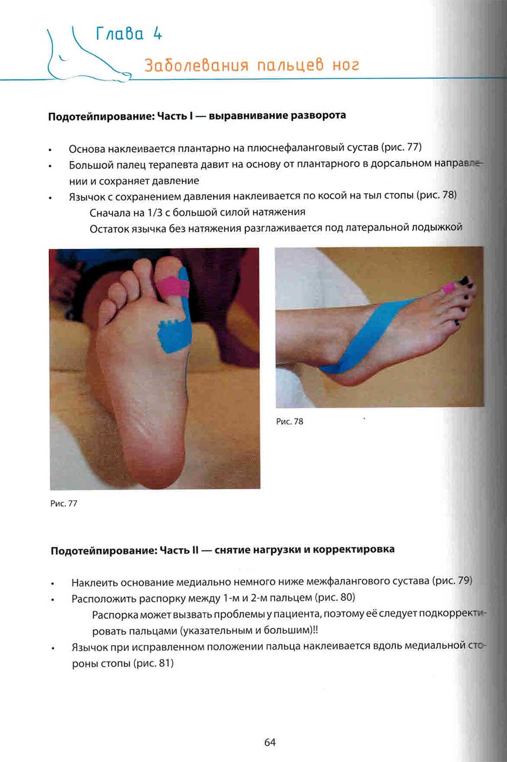 Заболевания пальцев ног