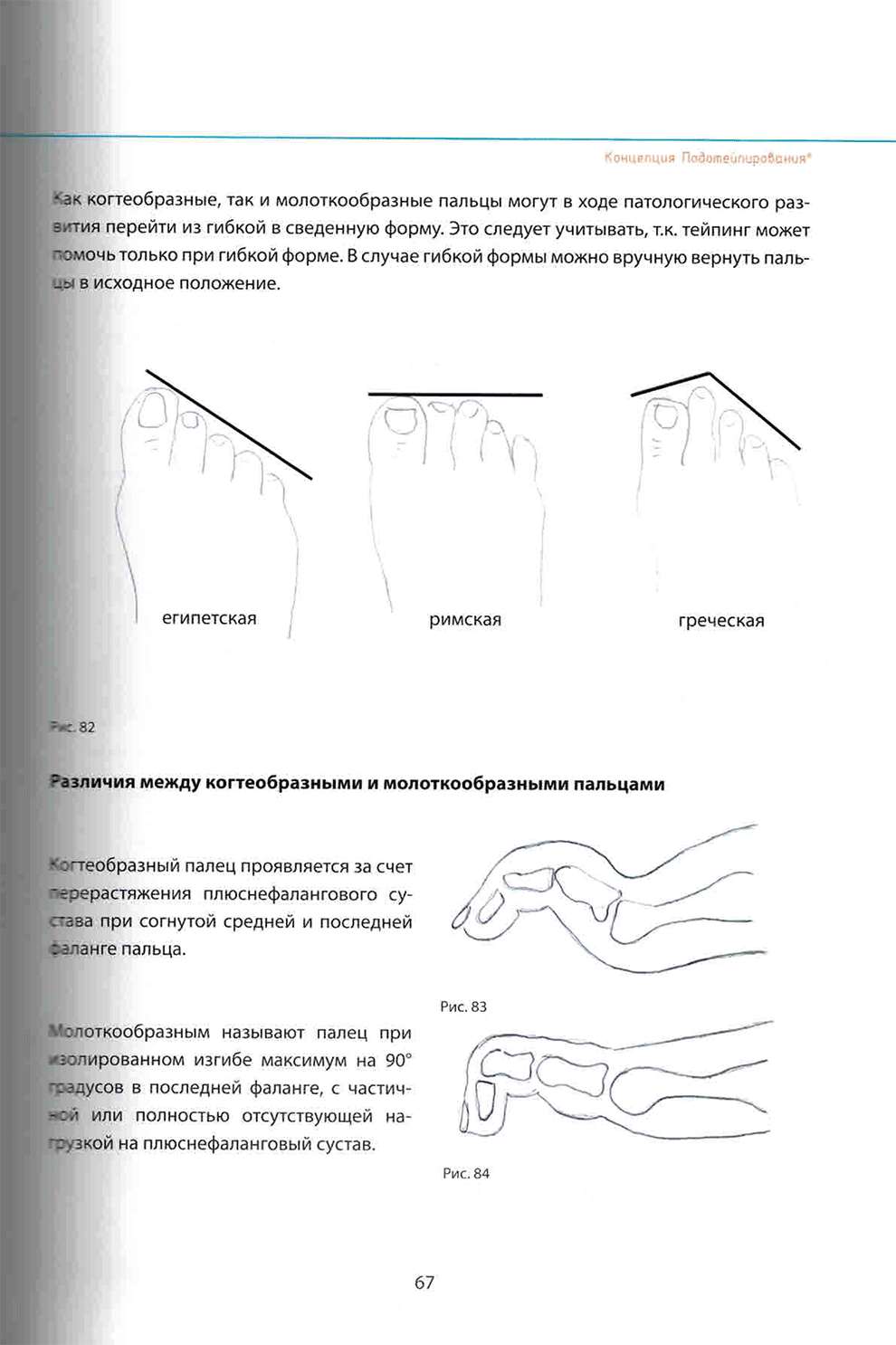 Различия между когтеобразными и молоткообразными пальцами