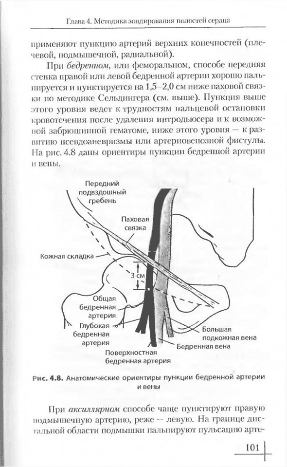 Анатомические ориентиры пункции бедренной артерии и вены Анатомические ориентиры пункции бедренной артерии и вены