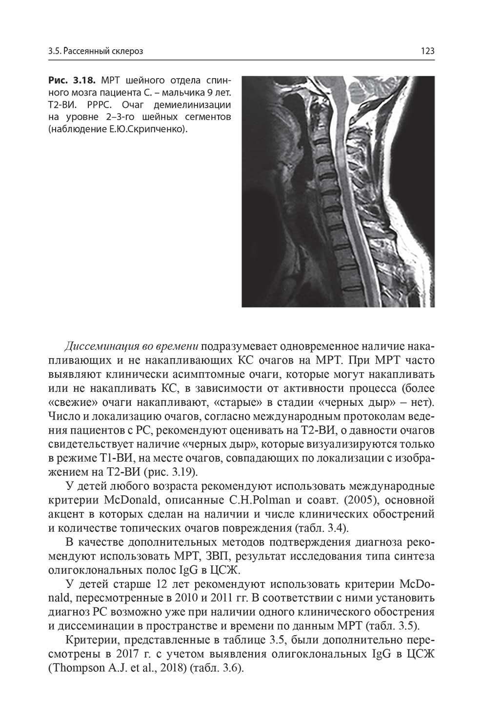 Рис. 3.18. MPT шейного отдела спинного мозга пациента С. - мальчика 9 лет.