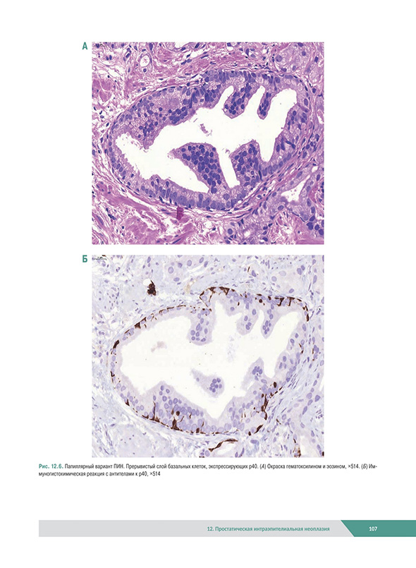 Морфологическая диагностика заболеваний простаты Морфологическая диагностика заболеваний простаты