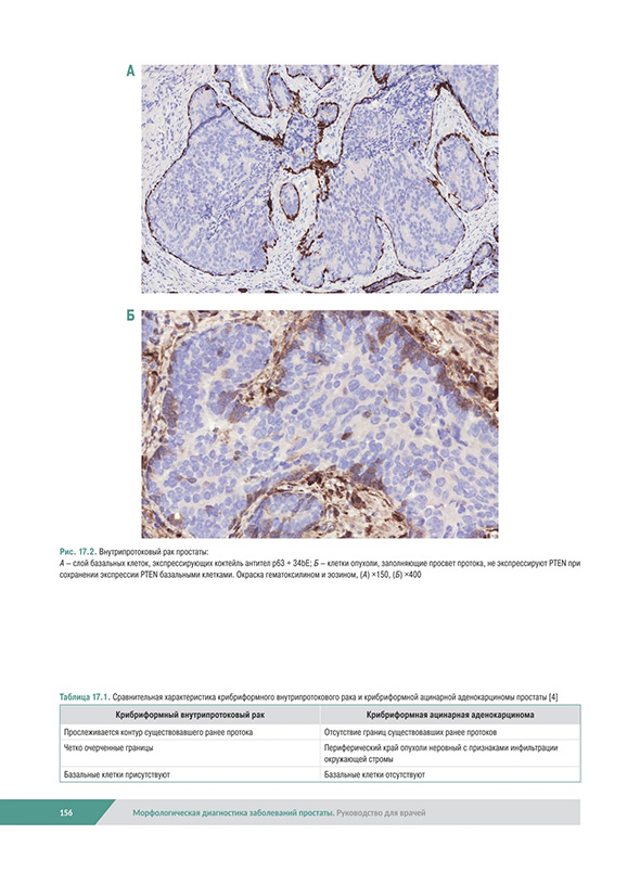 Морфологическая диагностика заболеваний простаты Морфологическая диагностика заболеваний простаты