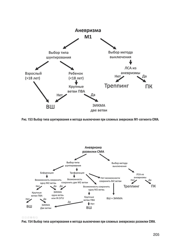 Выбор типа шунтирования и метода выключения при сложных аневризмах развилки СМА.