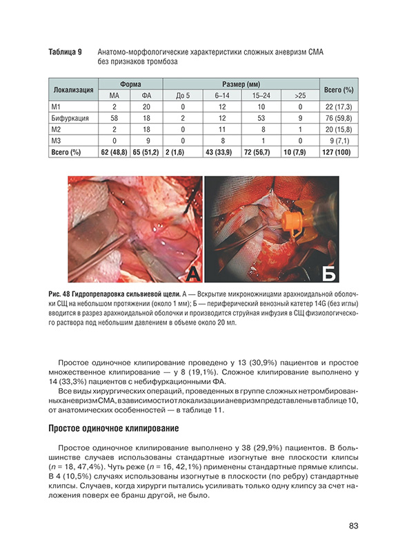 Гидропрепаровка сильвиевой щели.