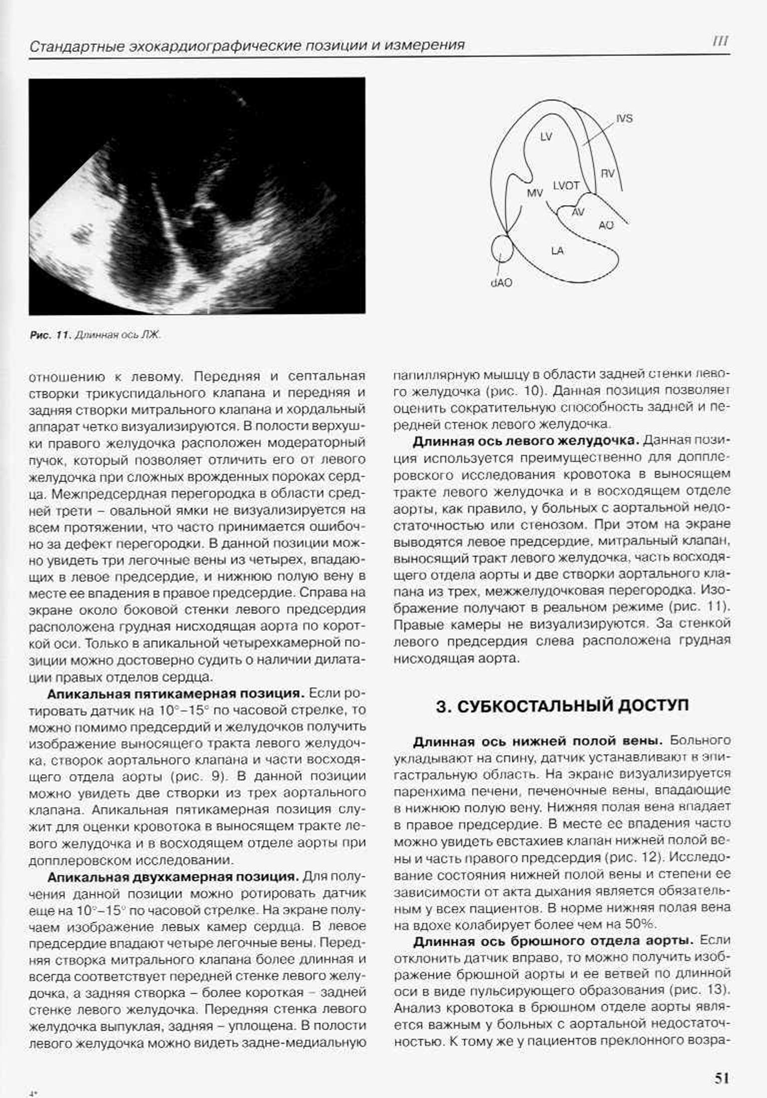 Длинная ось ЛЖ Длинная ось ЛЖ