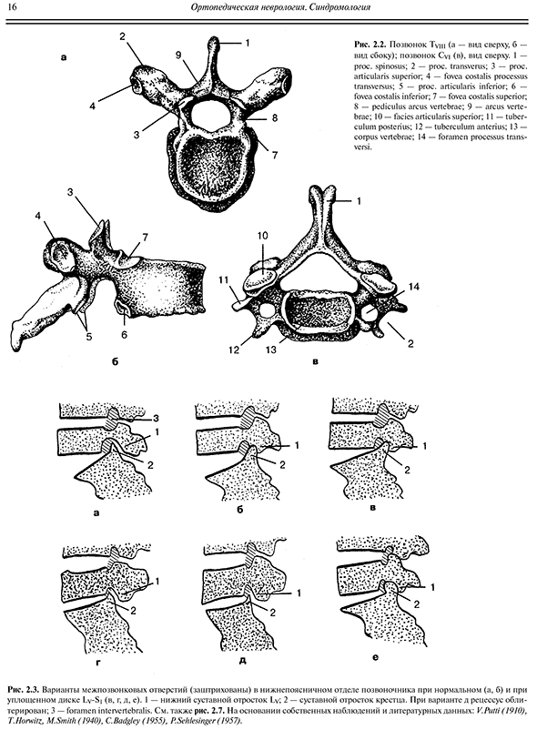 Варианты межпозвоночных отверстий