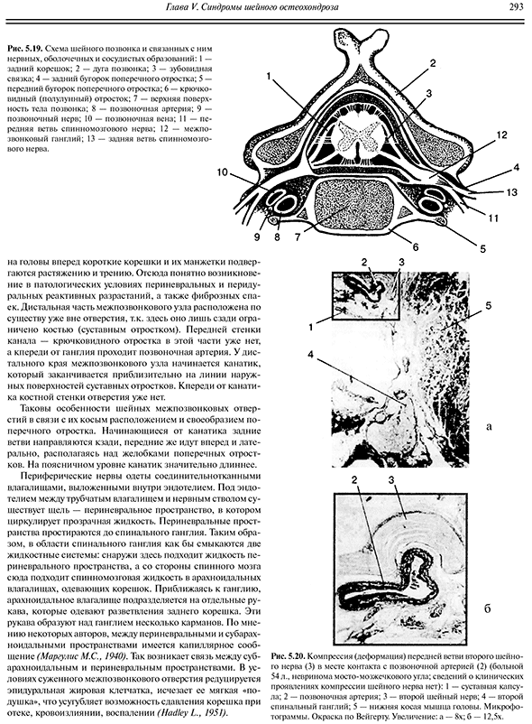 Компрессия (деформация) передней ветви второго шейного нерва