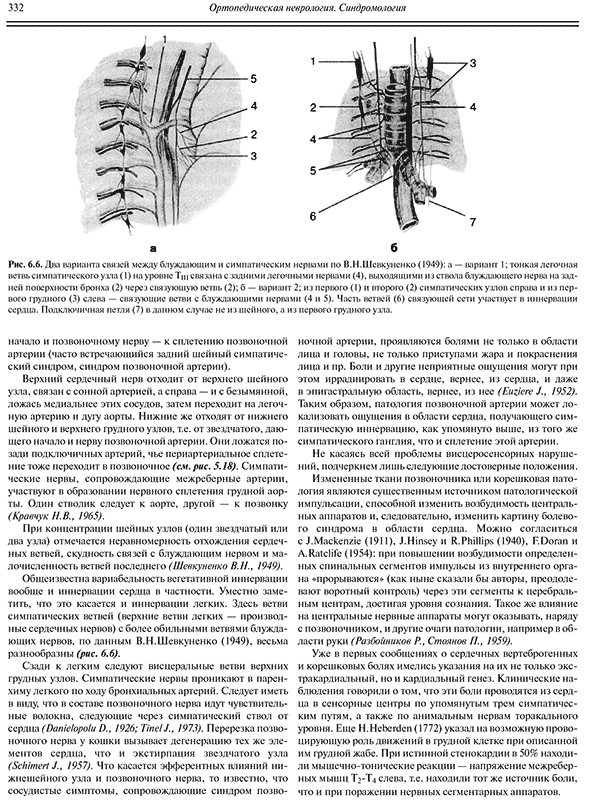 Два варианта связей между блуждающими и симпатическими нервами