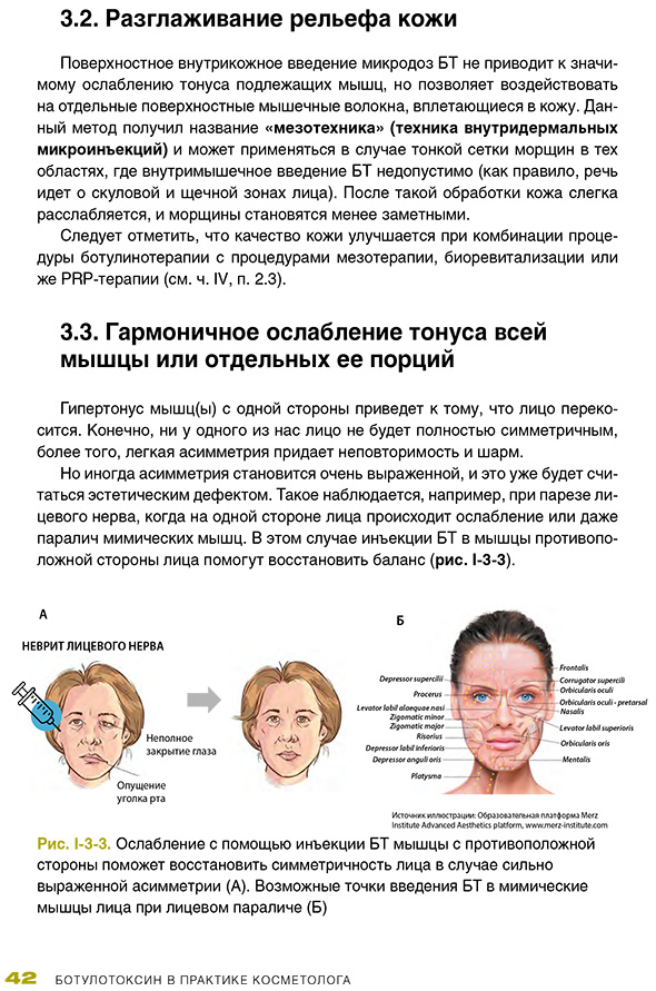 Ослабление с помощью инъекции БТ мышцы