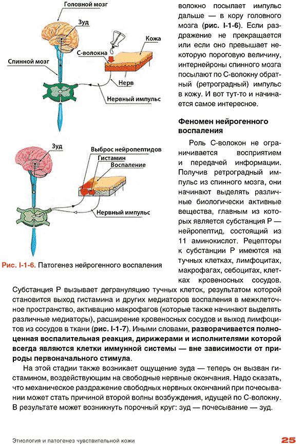 Патогенез нейрогенного воспаления