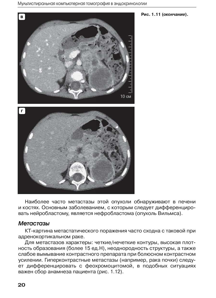 Пример страницы из книги "Мультиспиральная компьютерная томография в эндокринологии"