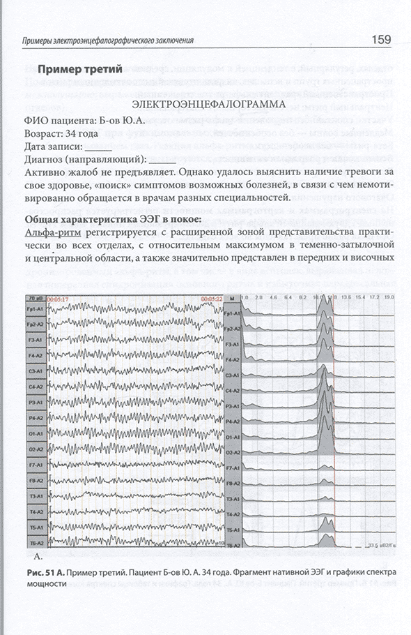 Пример третий. Пациент Б-ов Ю. А. 34 года.