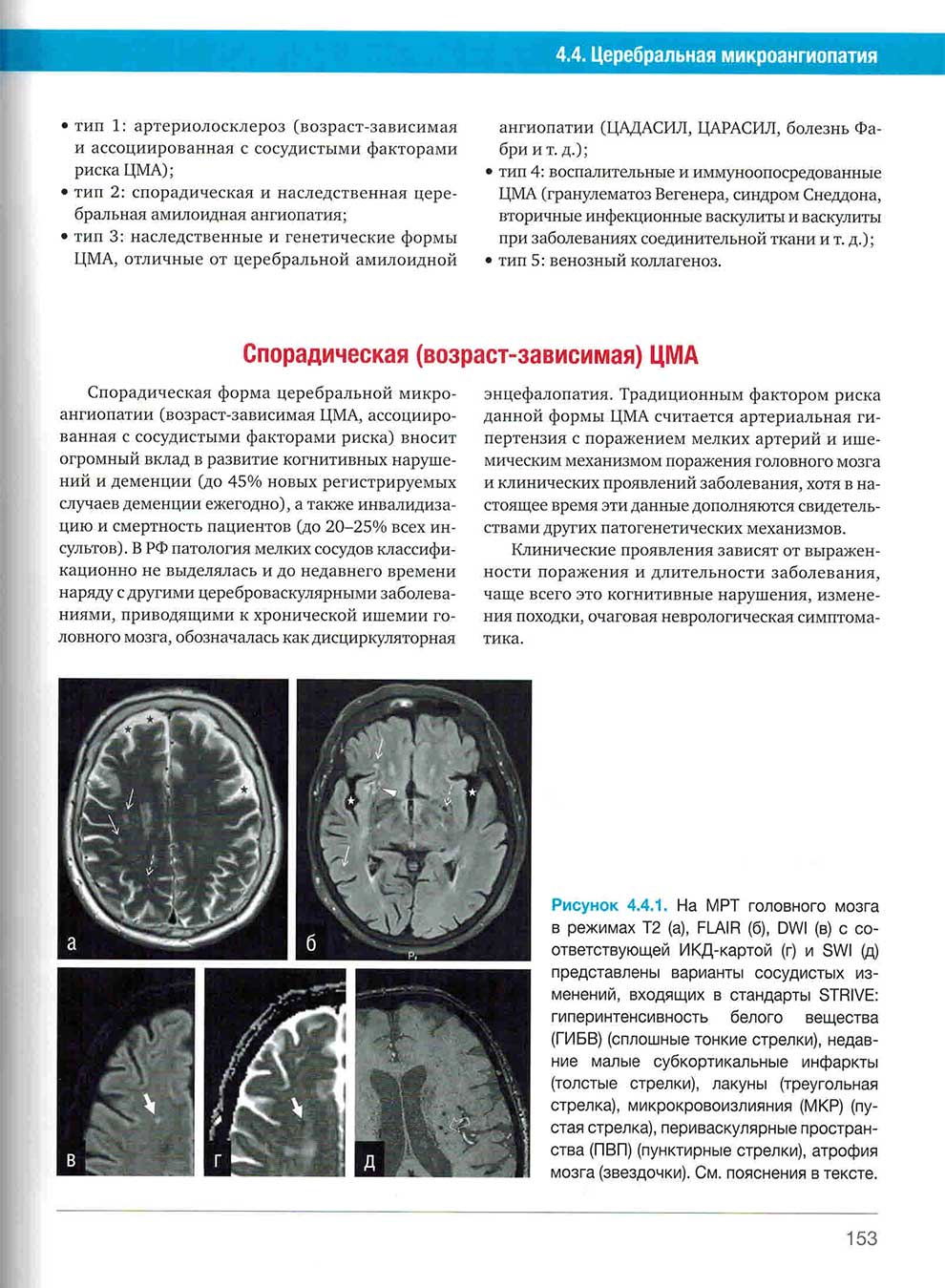 Рисунок 4.4.1. На MPT головного мозга в режимах Т2 (a), FLAIR (б), DWI (в) 