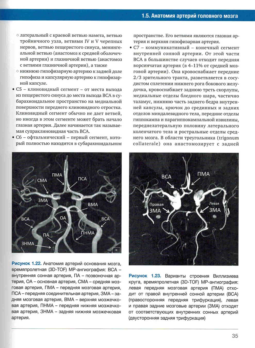 Рисунок 1.22. Анатомия артерий основания мозга