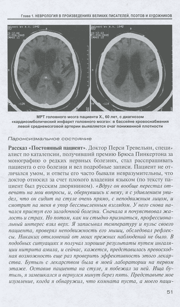 MPT головного мозга пациента X., 60 лет, с диагнозом