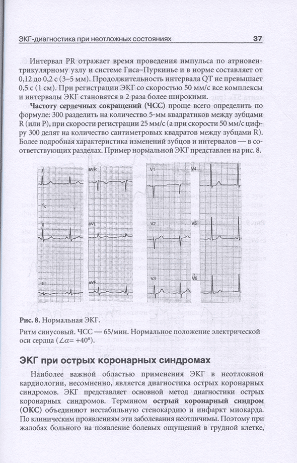 Рис. 8. Нормальная ЭКГ.