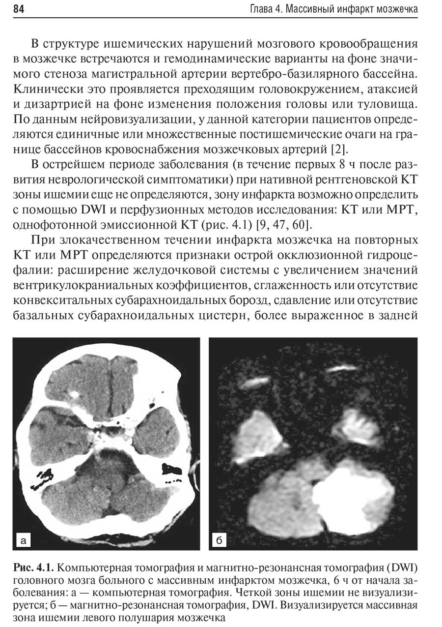 Рис. 4.1. Компьютерная томография и магнитно-резонансная томография (DWI)