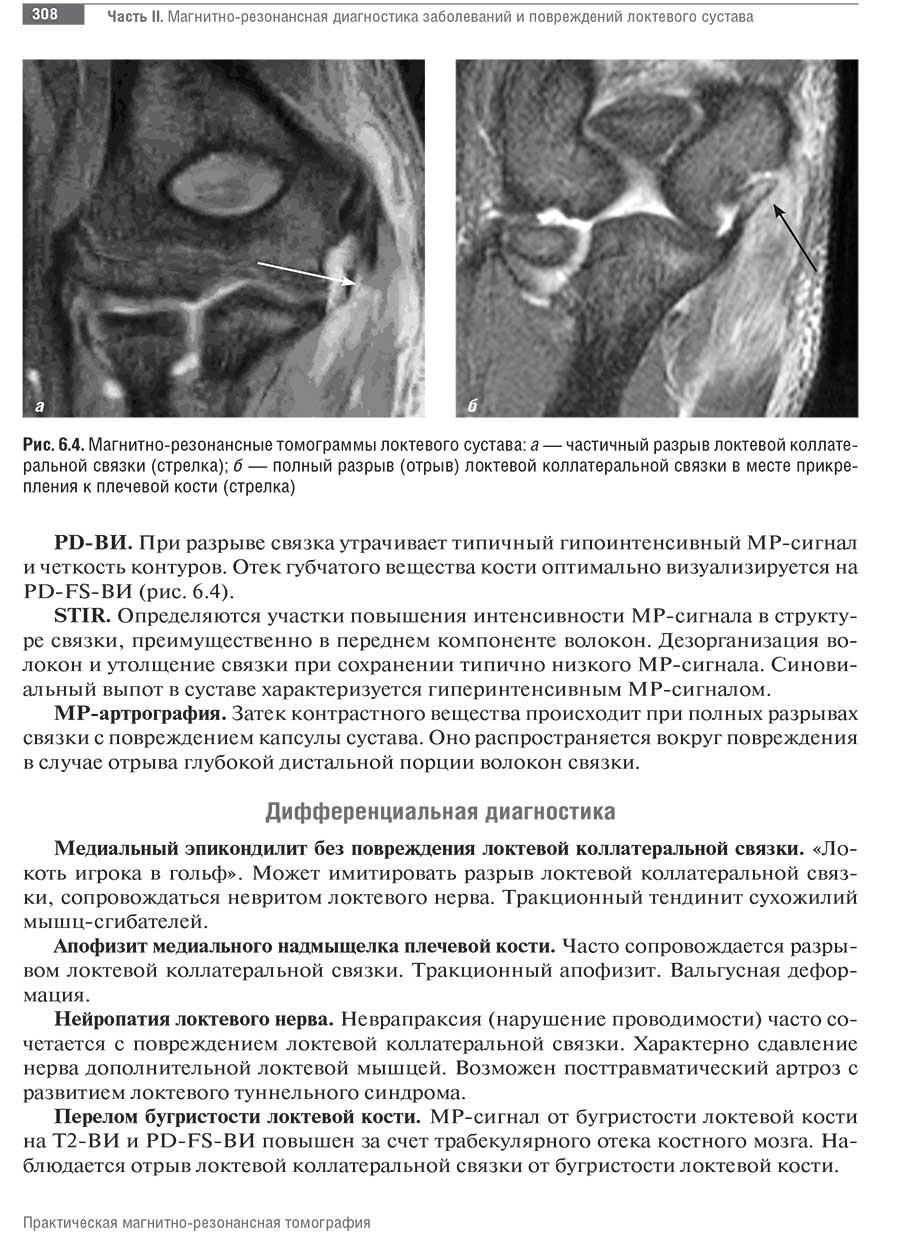 Магнитно-резонансные томограммы локтевого сустава