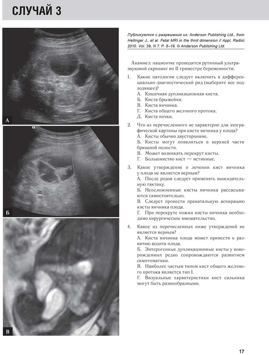 Анамнез: пациентке проводится рутинный ультразвуковой скрининг во II триместре беременности.