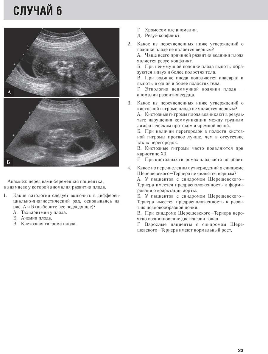 Анамнез: перед вами беременная пациентка, в анамнезе у которой аномалия развития плода.