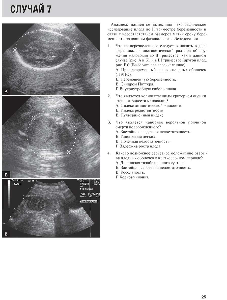 Анамнез: пациентке выполняют эхографическое исследование плода во II триместре беременности 