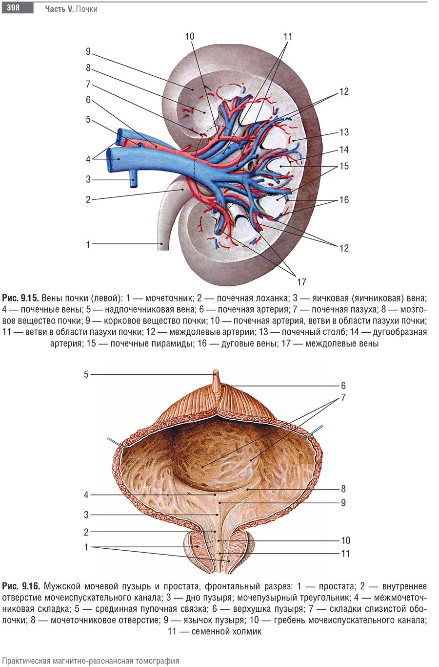 Мужской мочевой пузырь и простата, фронтальный разрез